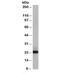 MAX Antibody