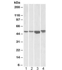 Western blot testing of human 1) HEK293, 2) A431, 3) HeLa and 4) Jurkat cell lysate with ILK antibod