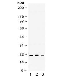 Western blot testing of 1) rat brain, 2) mouse brain, and 3) mouse HEPA lysate with HRAS antibody. E