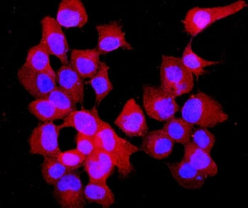 Annexin VII Antibody