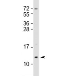 Mammaglobin A Antibody / MGB1