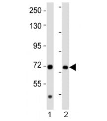 Western blot testing of AACS antibody at 1:2000 dilution. Lane 1: human kidney lysate; 2: rat brain