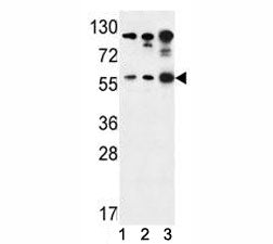 AKT1 Antibody