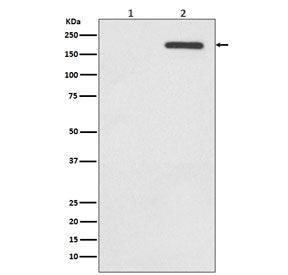 Phospho-EGF Receptor / EGFR Antibody (pY1068)