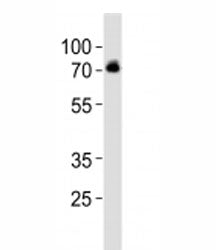 Western blot analysis of lysate from SH-SY5Y cell line using DBH antibody at 1:1000. Predicted molec