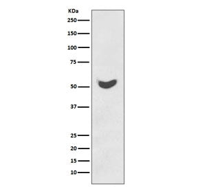 Western blot testing of human HeLa cell lysate with KRT7 antibody. Predicted molecular weight ~51 kD