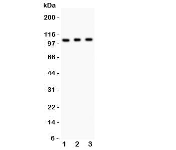 GRIK1 Antibody