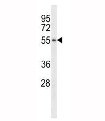 Western blot analysis of TSPY antibody pre-incubated without (Lane 1) and with (2) blocking peptide