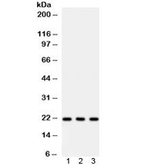 Western blot testing of 1) human MCF7, 2) human SW620 and 3) rat lung lysate with Syndecan 4 antibod