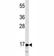 Calcitonin Antibody / CALCA / CGRP, 0.08ml