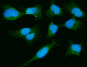 Parkinson disease protein 7 Antibody / PARK7