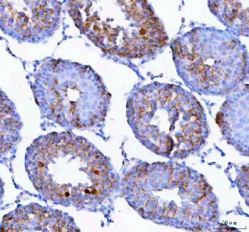 Epigen Antibody / Epgn