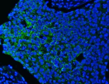 PITPNB Antibody / PI-TP-beta