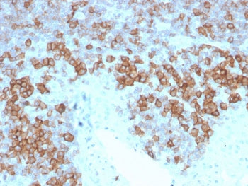 IHC staining of FFPE human tonsil with CD27 antibody (clone LPFS2/4177). HIER: boil tissue sections