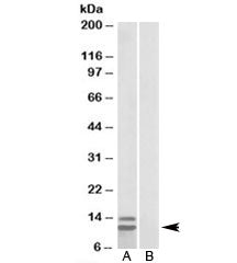P15 INK4b Antibody (isoform 2)