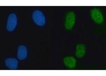 Immunofluorescent staining of FFPE human U-2 OS cells with ZMYM2 antibody (green) and DAPI nuclear s