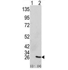 GRB2 Antibody