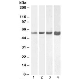 Western blot testing of 1) human, 2) mouse, 3) rat and 4) pig skeletal muscle lysate with Desmin ant