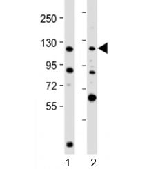 NOP2 Antibody / Nucleolar protein 2