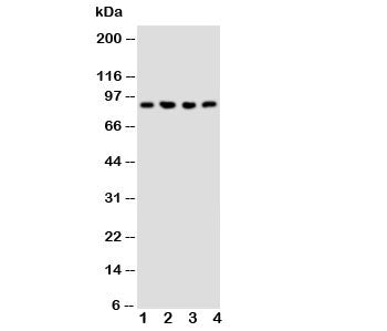 Western blot testing of NRG2 antibody and Lane 1: rat liver; 2: human COLO320; 3: SMMC-7721; 4: SW62