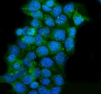 CLPP Antibody