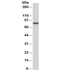 Western blot testing of A431 cell lysate with Gamma Catenin antibody at 2ug/ml. Predicted molecular