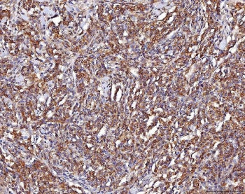 Alpha Enolase Antibody / ENO1 / Enolase 1