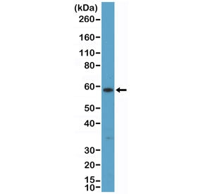 Cytokeratin 10 Antibody