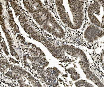 AUF1 Antibody / hnRNP D / HNRNPD