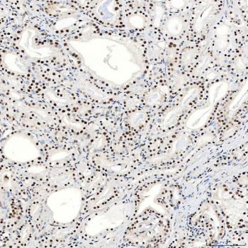 SNRNP40 Antibody / U5-40K