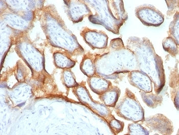 HCG-beta Antibody Cocktail
