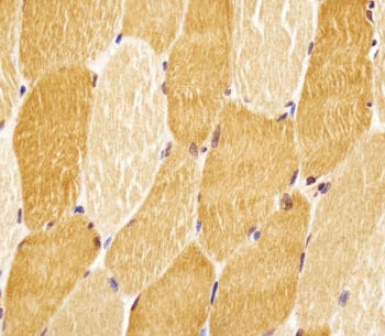 IHC testing of FFPE human skeletal muscle tissue with SLC29A2 antibody. HIER: steam section in pH6 c