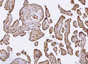 PKIB Antibody / PKI beta / PRKACN2