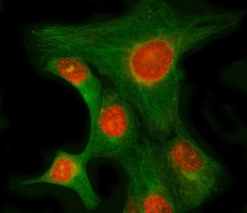 Immunofluorescent staining of FFPE human HeLa cells with RIMKLB antibody (red) and Beta Tubulin mAb