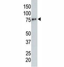 Anti-HA tag antibody testing a tagged recombinant protein.