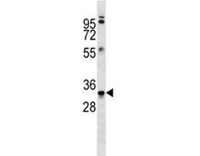 MBP Antibody