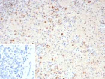 IHC staining of FFPE human spleen tissue with Resistin antibody (clone RETN/4325). Inset: PBS used i