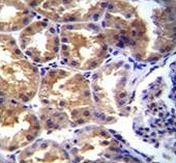 TRPM6 antibody immunohistochemistry analysis in formalin fixed and paraffin embedded human kidney ti