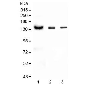 Western blot testing of 1) human Raji and 2) rat thymus and 3) mouse thymus lysate with CD22 antibod