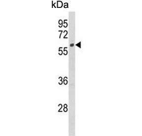 CYP7B1 Antibody