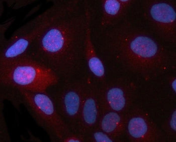 CEP164 Antibody / Centrosomal protein of 164 kDa