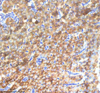 IHC staining of zebrafish Nanos3 protein using Zebrafish Nanos3 antibody, HRP-labeled secondary and