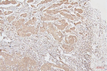 HMGB1 Antibody