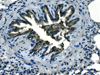 IHC staining of FFPE rat lung with Olr1 antibody. HIER: boil tissue sections in pH8 EDTA for 20 min