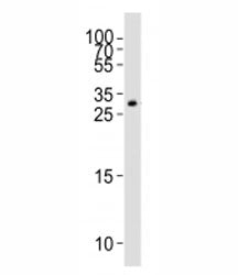 Western blot analysis of lysate from HT-1080 cell line using GDF15 antibody; Ab was diluted at 1:100