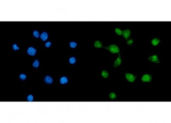 TAF8 Antibody / TBN