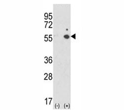 Western blot analysis of ICAM-1 antibody and 293 cell lysate (2 ug/lane) either nontransfected (Lane