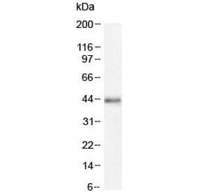 CDK9 Antibody (C-Terminal Region)