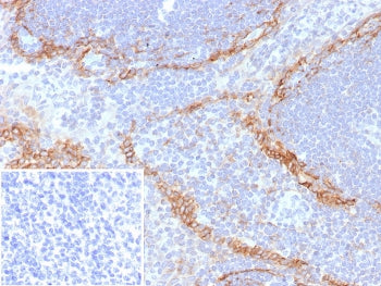 IHC staining of FFPE human tonsil tissue with recombinant PDPN antibody (clone rPDPN/6994). Inset: P