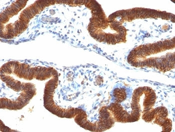 EpCAM Antibody